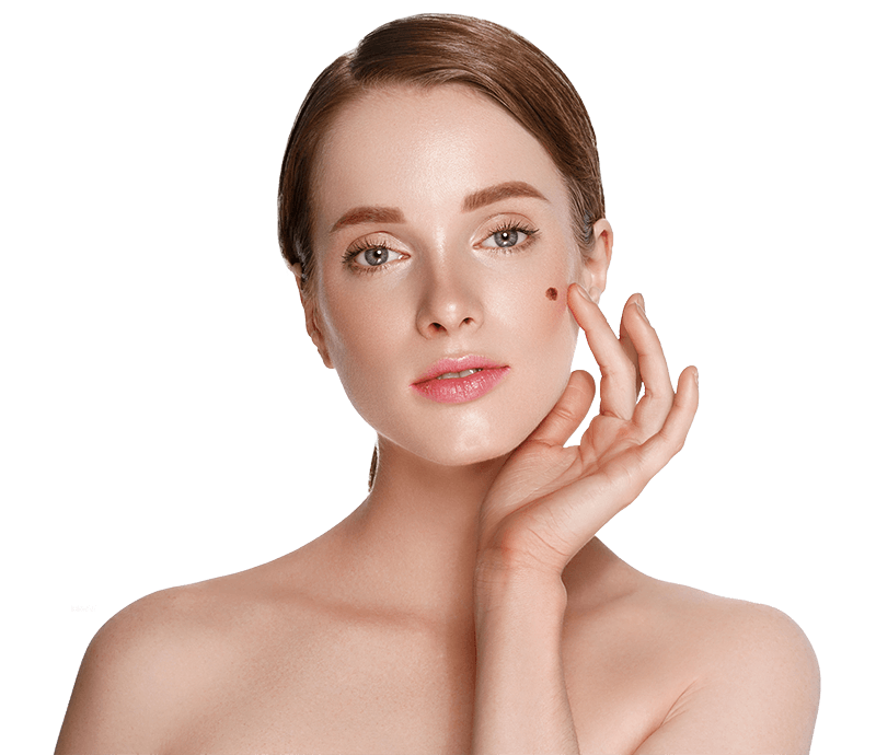 Mole Removal Cape Cod Massachusetts Dartmouth Providence Rhode Island