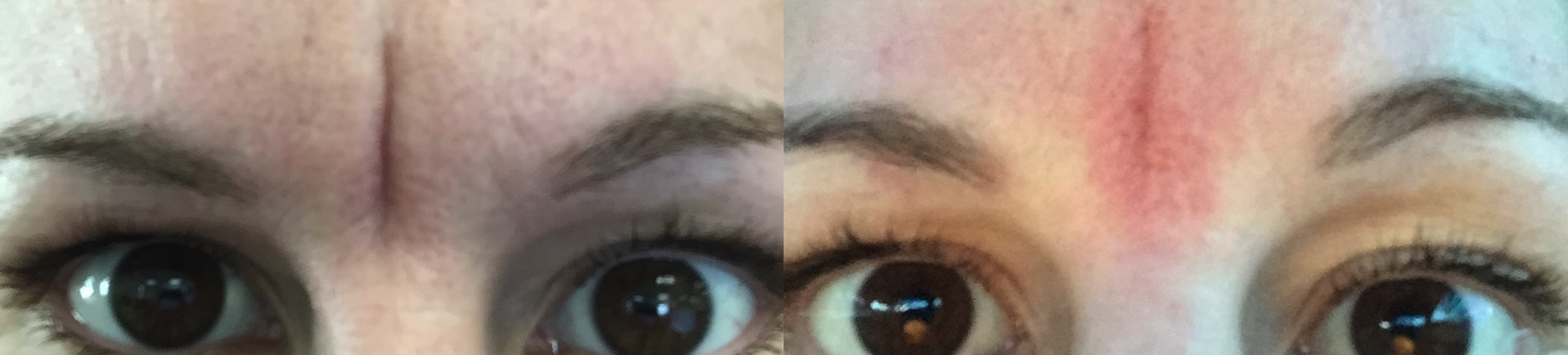 Before and After Image