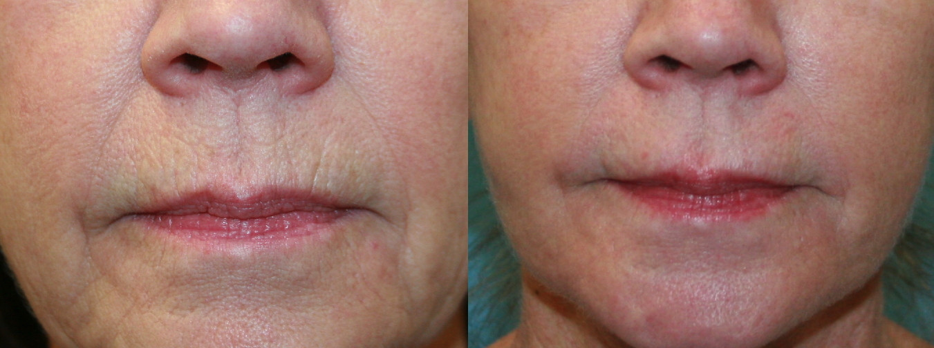 Before and After Image