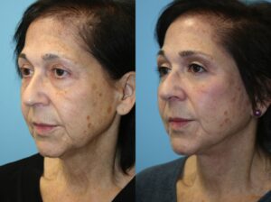 Before and After Image