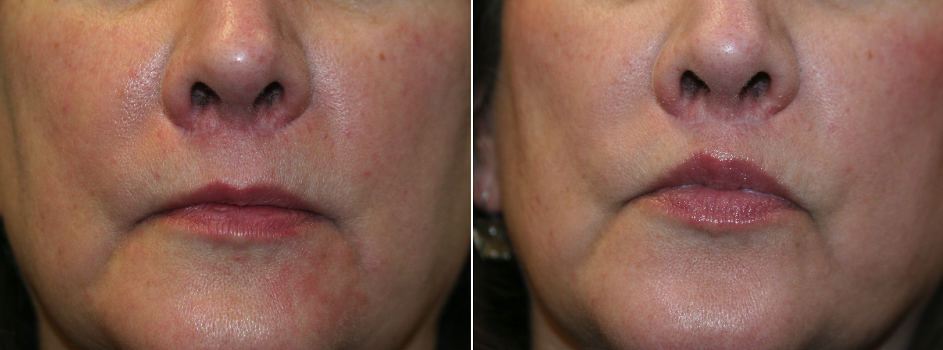 Before and After Image