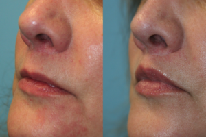 Before and After Image