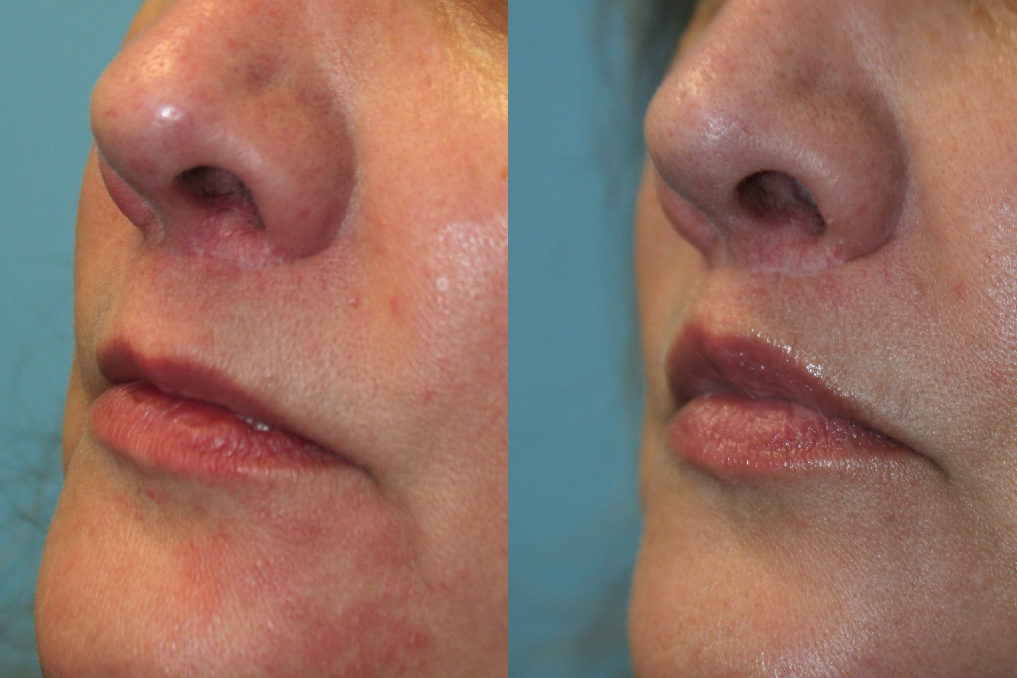 Before and After Image