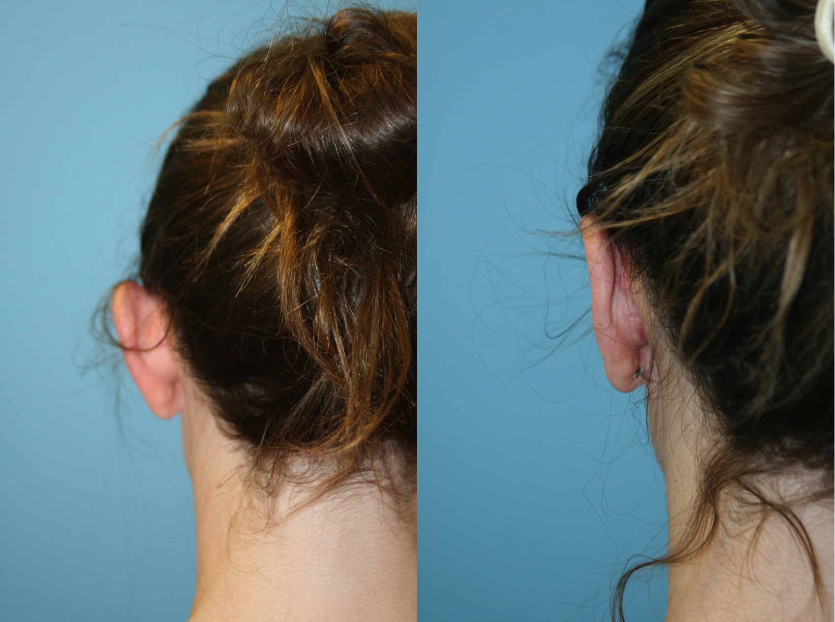 Before and After Image