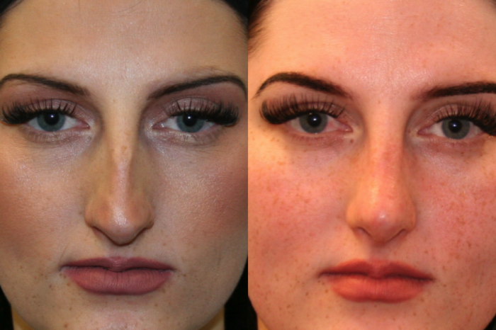 Before and After Image