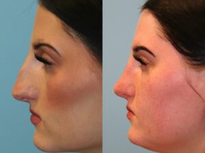 Before and After Image