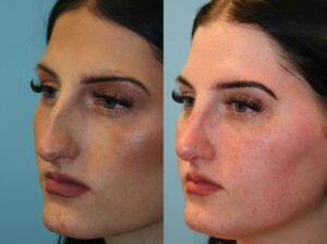 Before and After Image