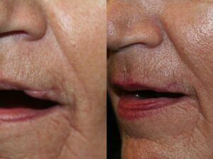 Before and After Image