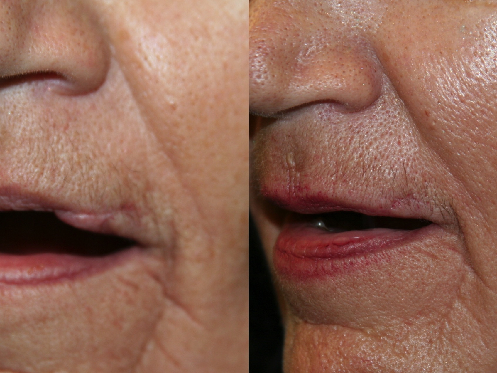 Before and After Image