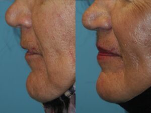 Before and After Image