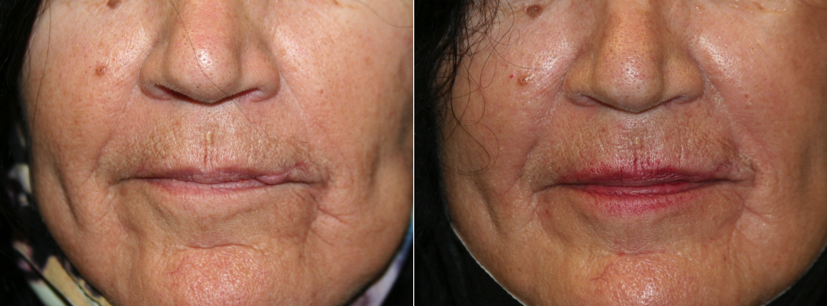 Before and After Image