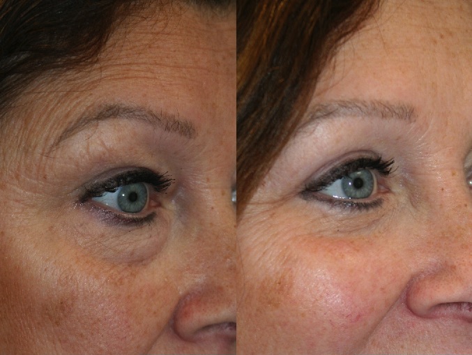 Before and After Image