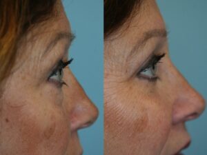 Before and After Image