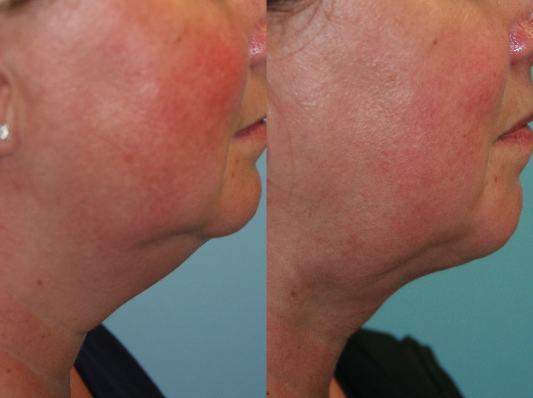 Before and After Image