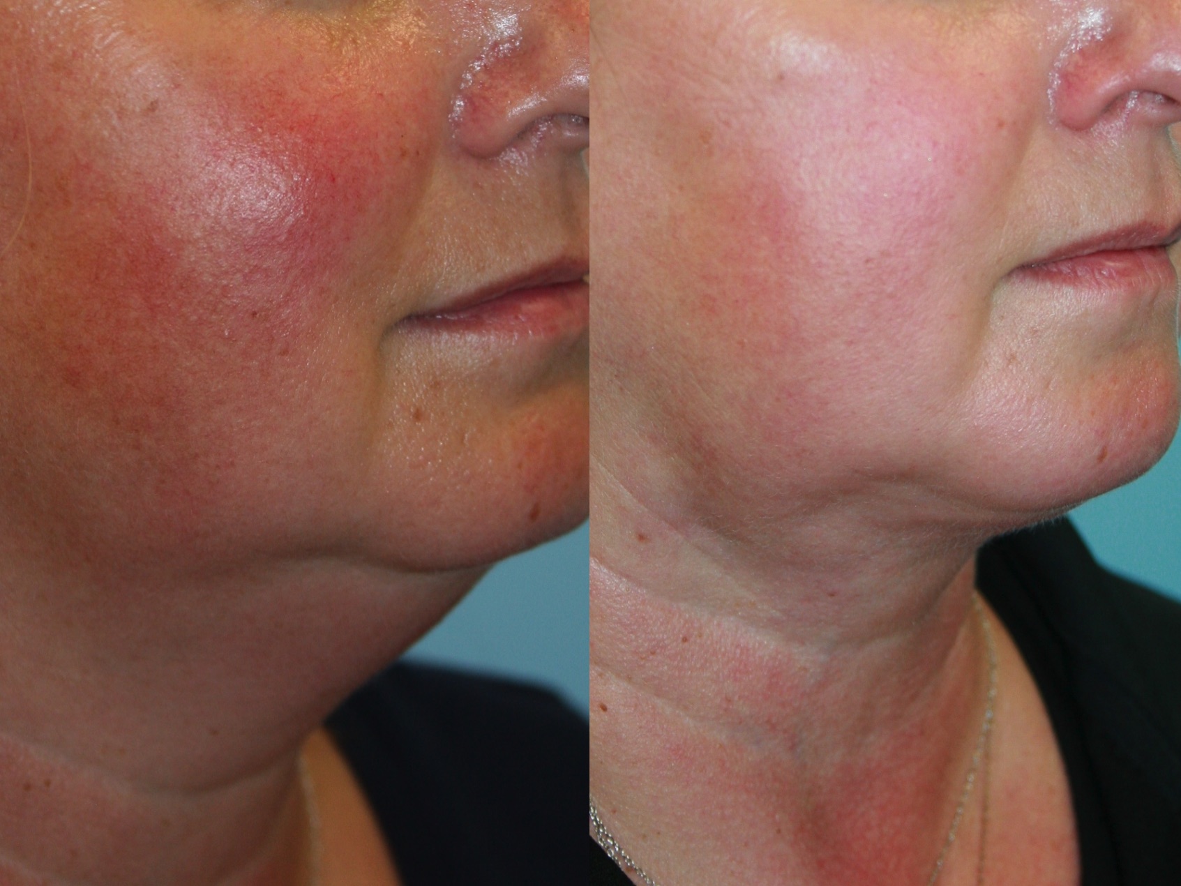 Before and After Image