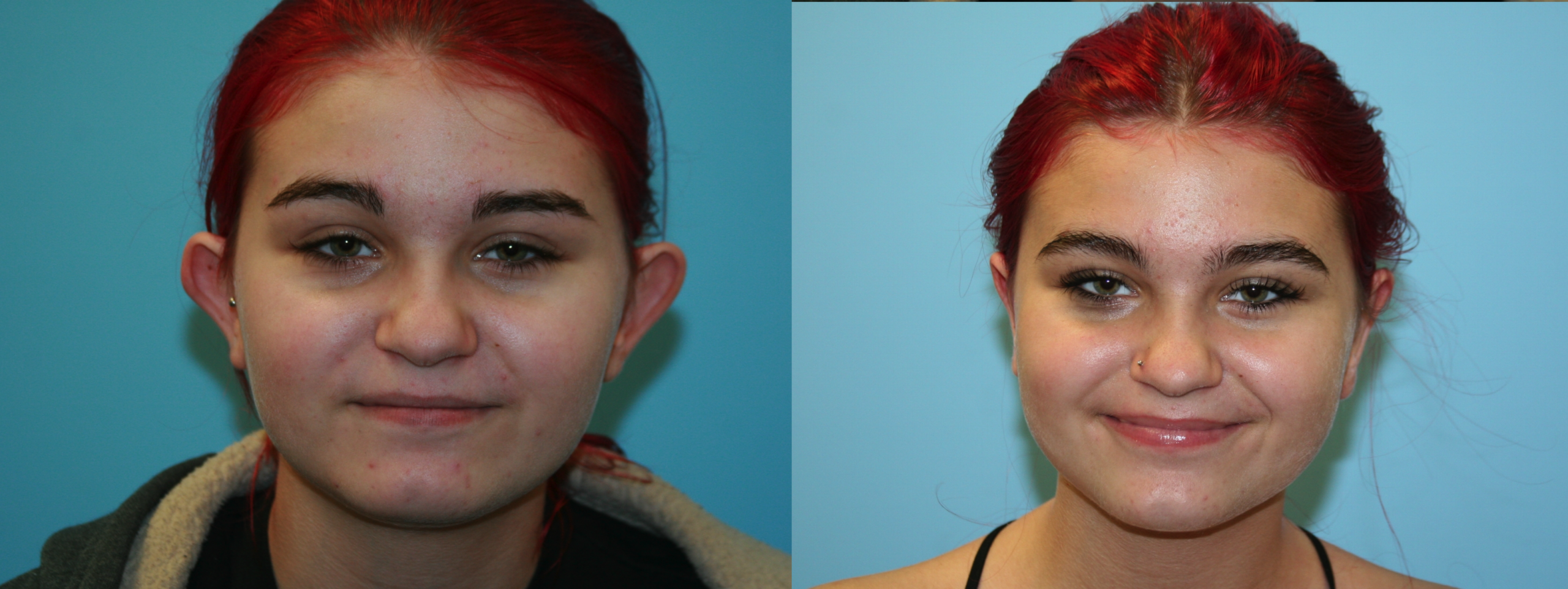 Before and After Image