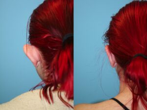 Before and After Image