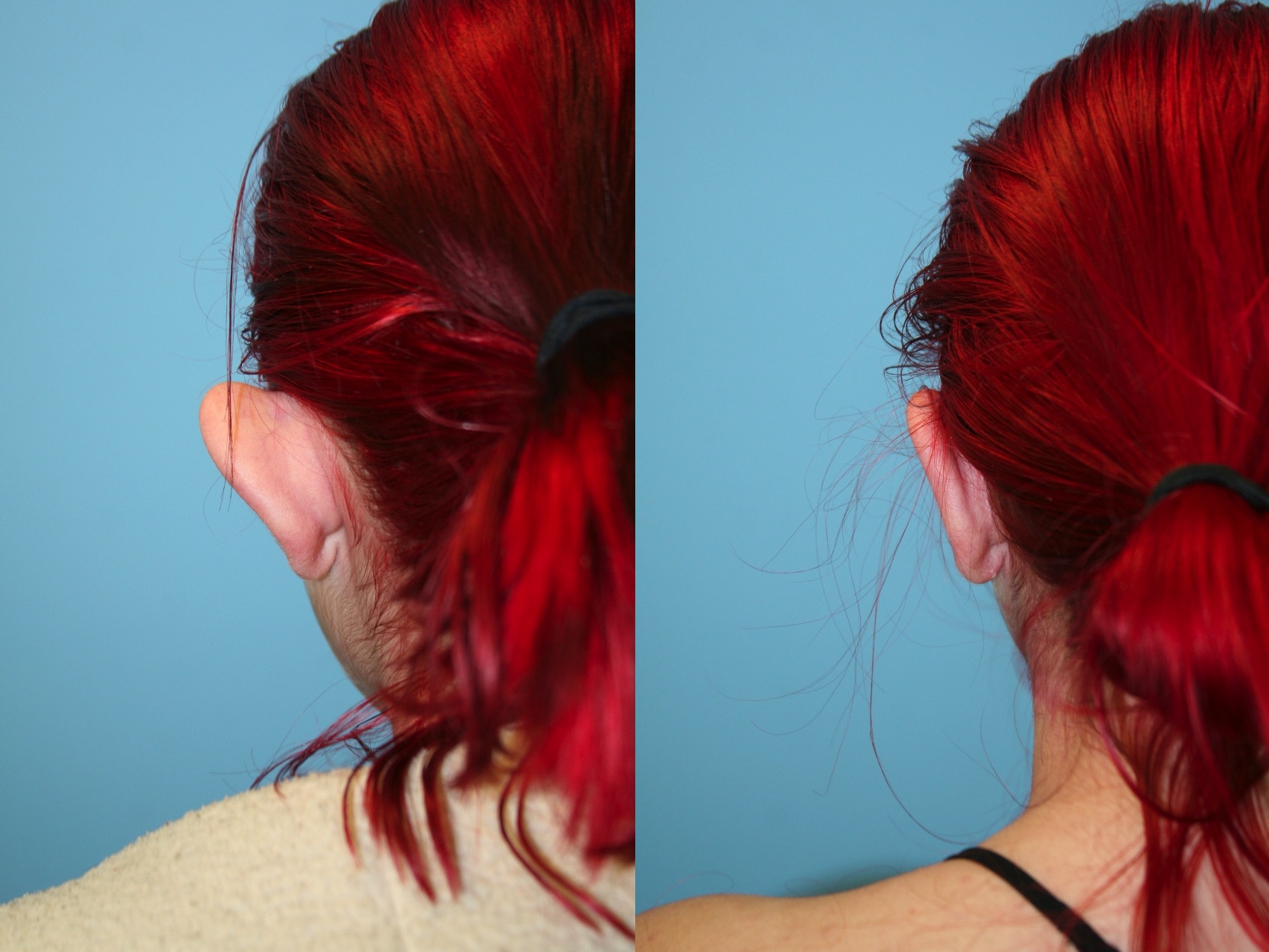 Before and After Image