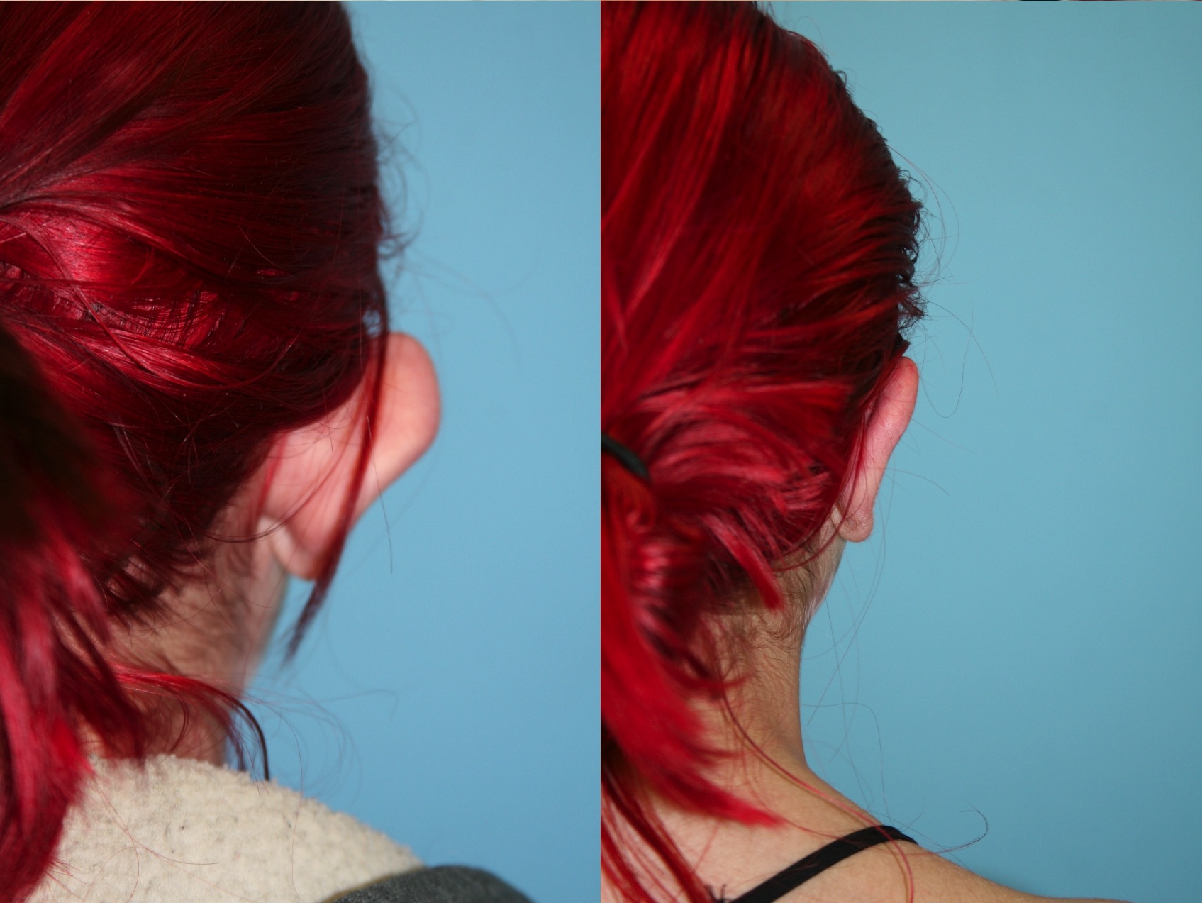 Before and After Image