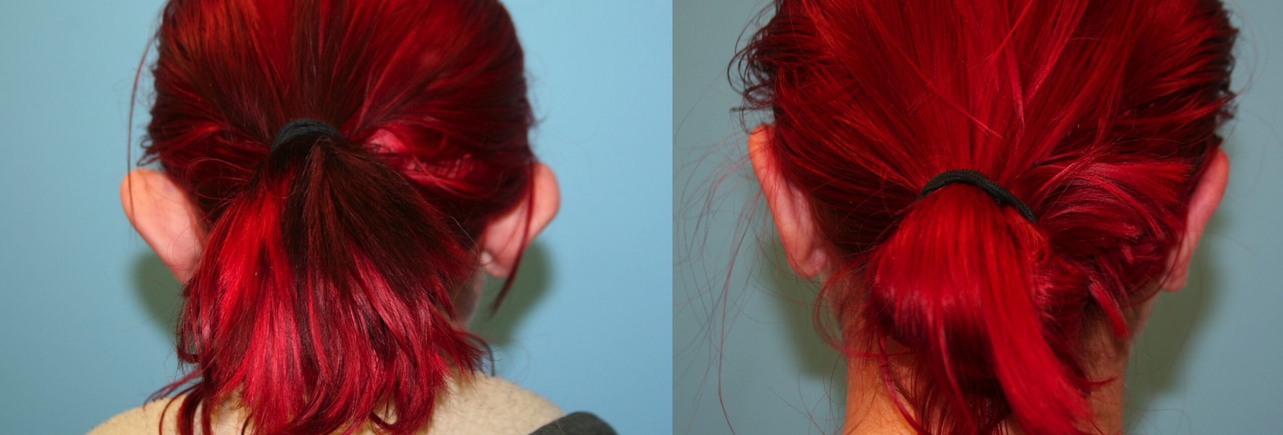 Before and After Image