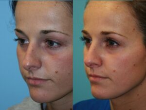 Before and After Image