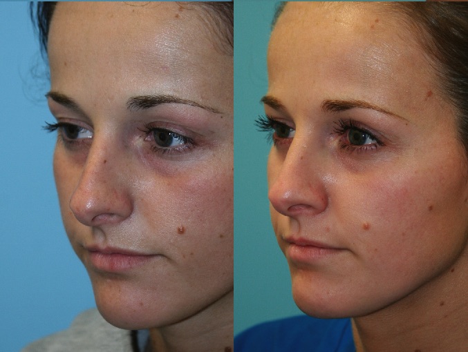 Before and After Image