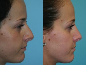 Before and After Image