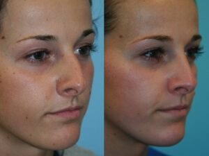 Before and After Image