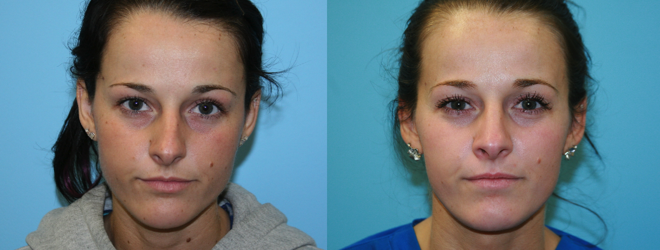 Before and After Image