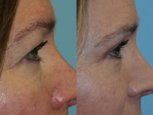 Before and After Image