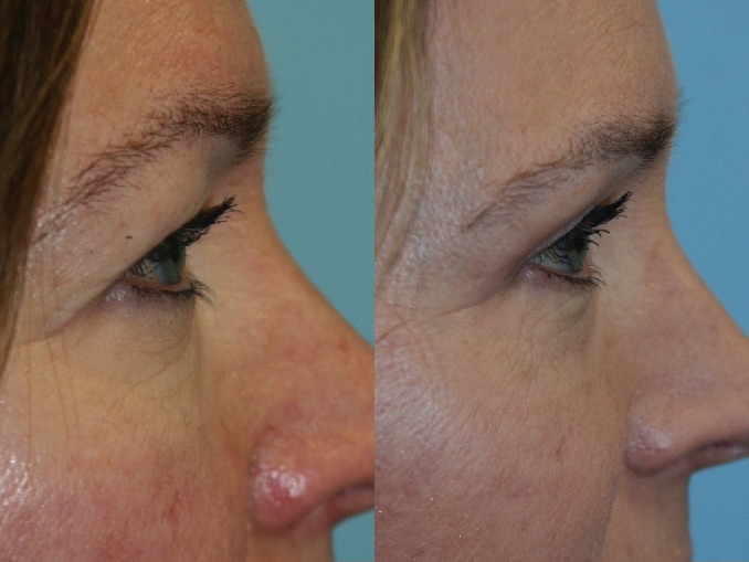 Before and After Image