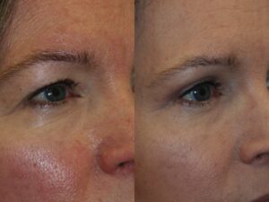 Before and After Image