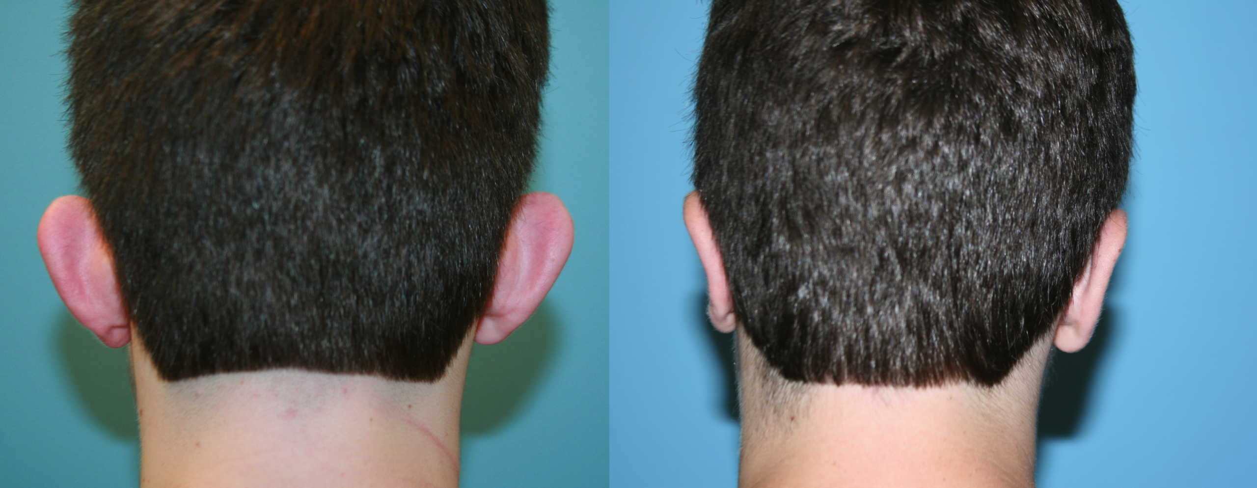 Before and After Image