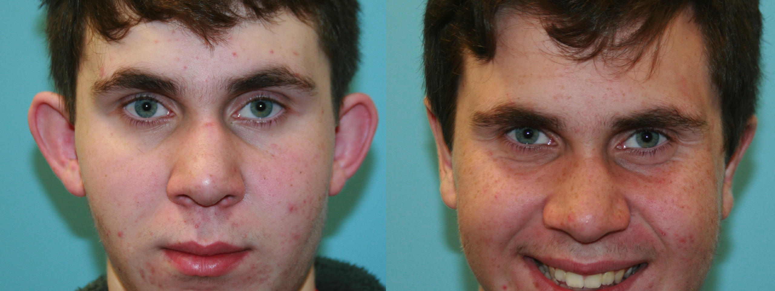 Before and After Image