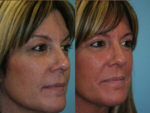 Before and After Image