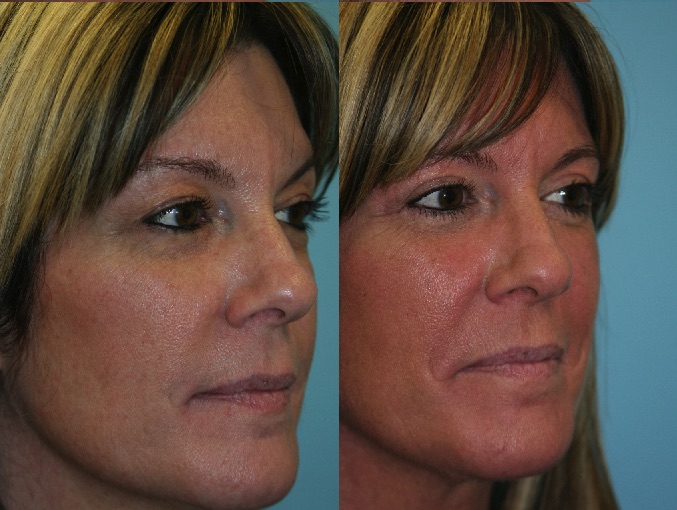 Before and After Image