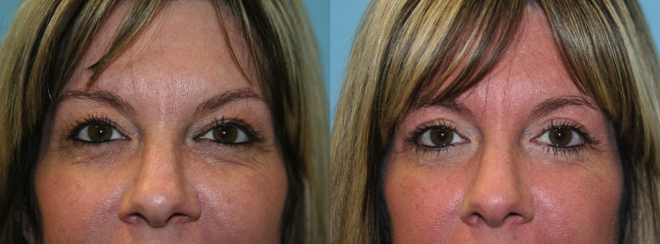 Before and After Image