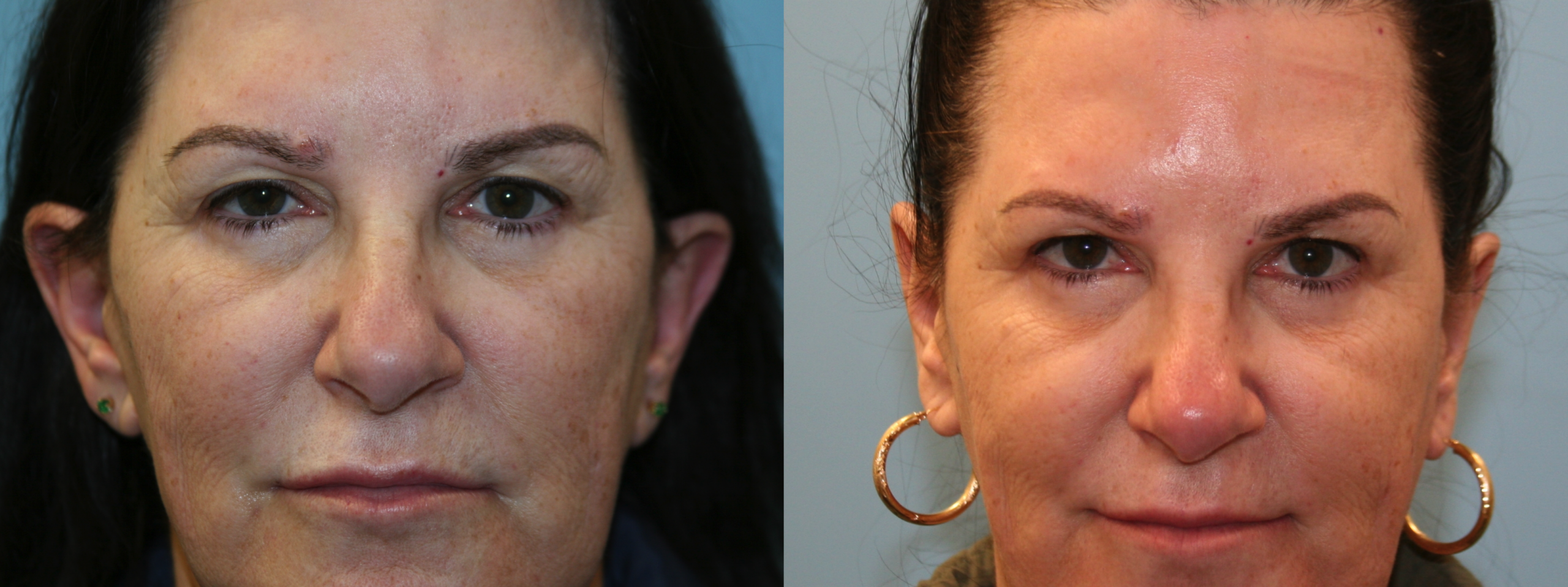 Before and After Image