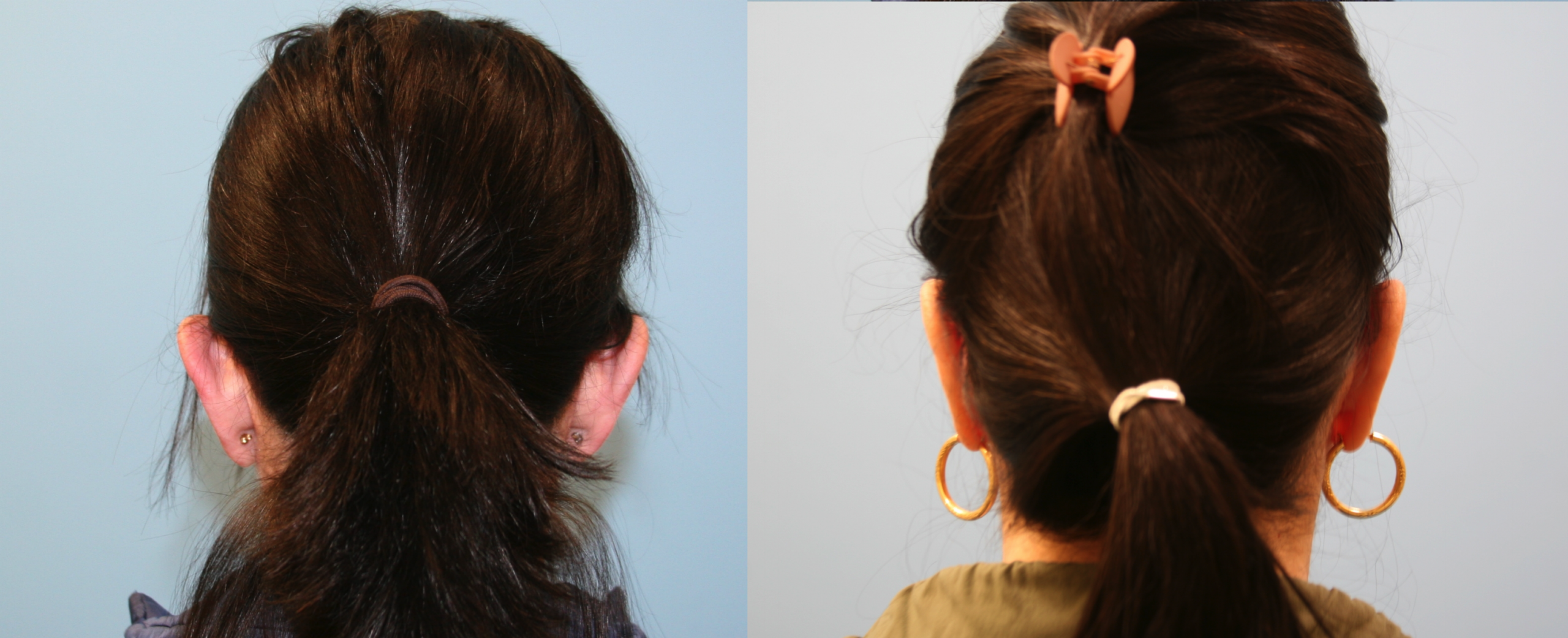 Before and After Image