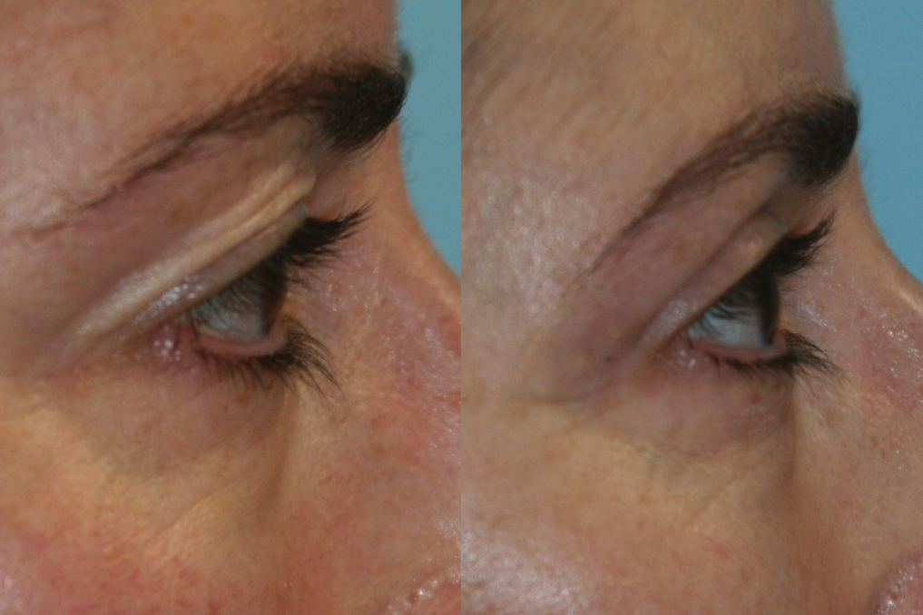 Before and After Image