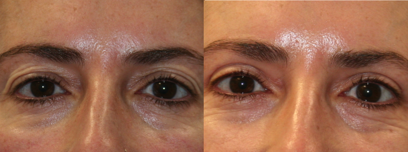 Before and After Image