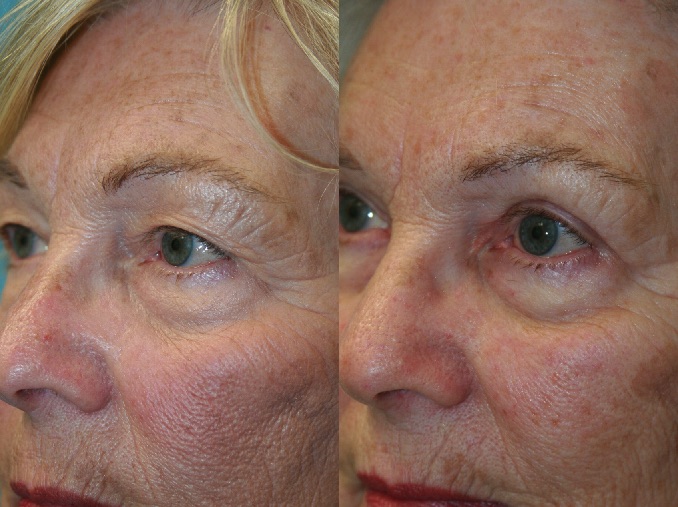 Before and After Image