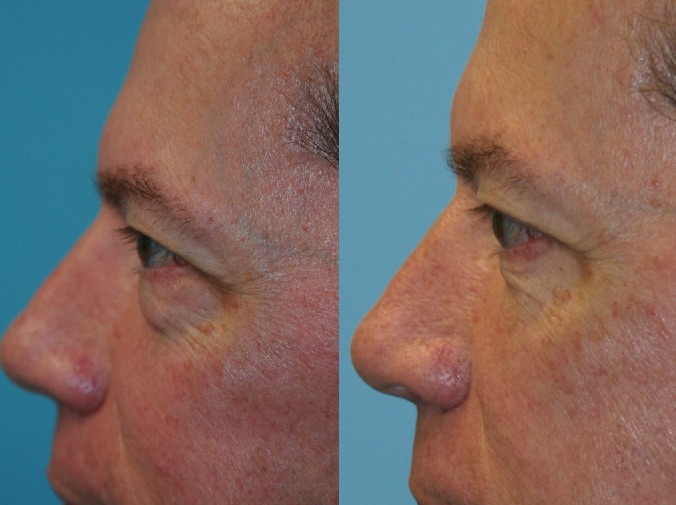 Before and After Image