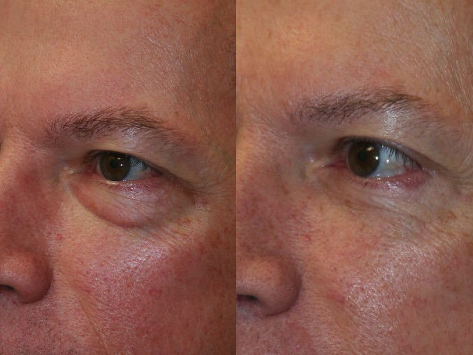 Before and After Image