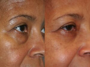 Before and After Image