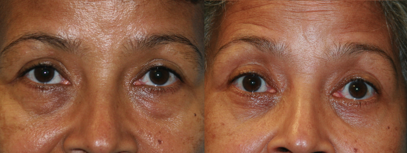 Before and After Image