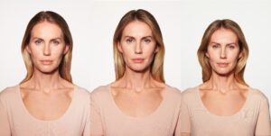 Before and After Image