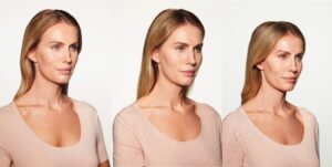 Before and After Image