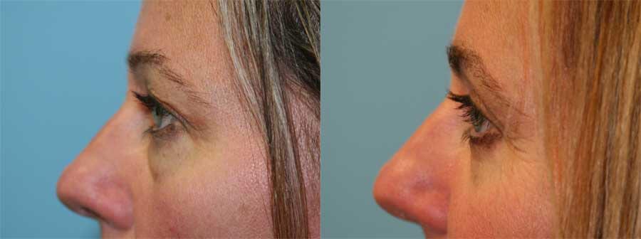 Before and After Image