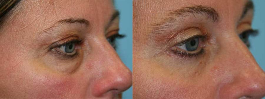 Before and After Image